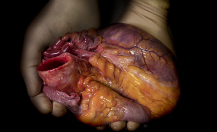 Mani di un chirurgo con un cuore in mano