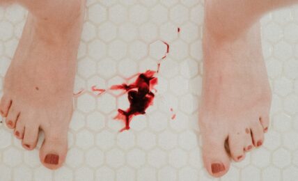 gocce di sangue sul pavimento tra due piedi di donna